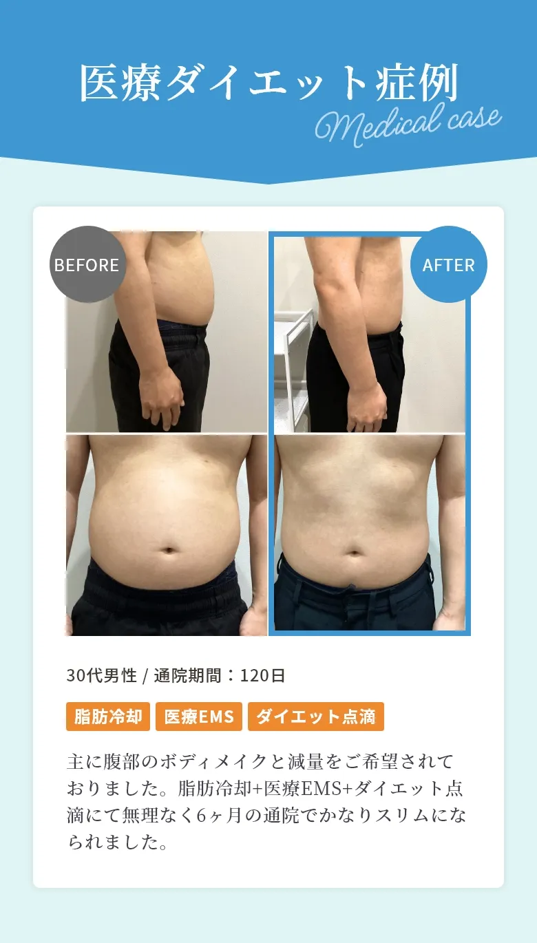 食事制限・運動なしですぐに効果を実感!医療ダイエットが選ばれる理由徹底比較