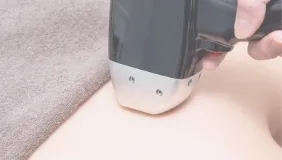 removal
